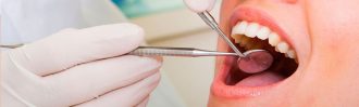 tratamiento periodoncia Caredental Albacete Clínica Dental